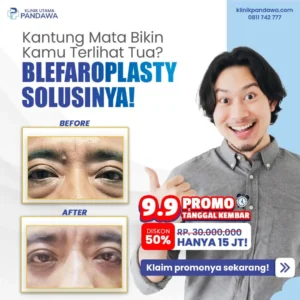 Promo 99 Bedah Estetika Blepharoplasty