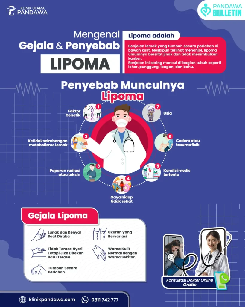 Infografis Lipoma Klinik Pandawa