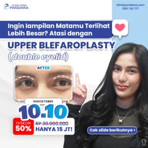 Promo 10.10 Eyelid