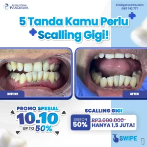 Promo 10.10 Scalling