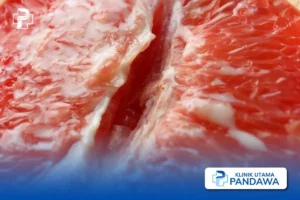 bentuk labia minora yang normal