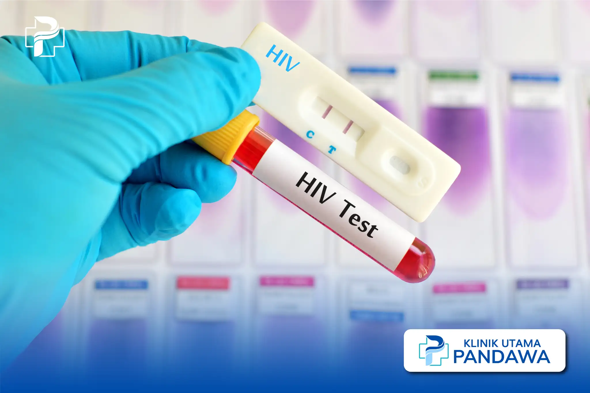 HIV