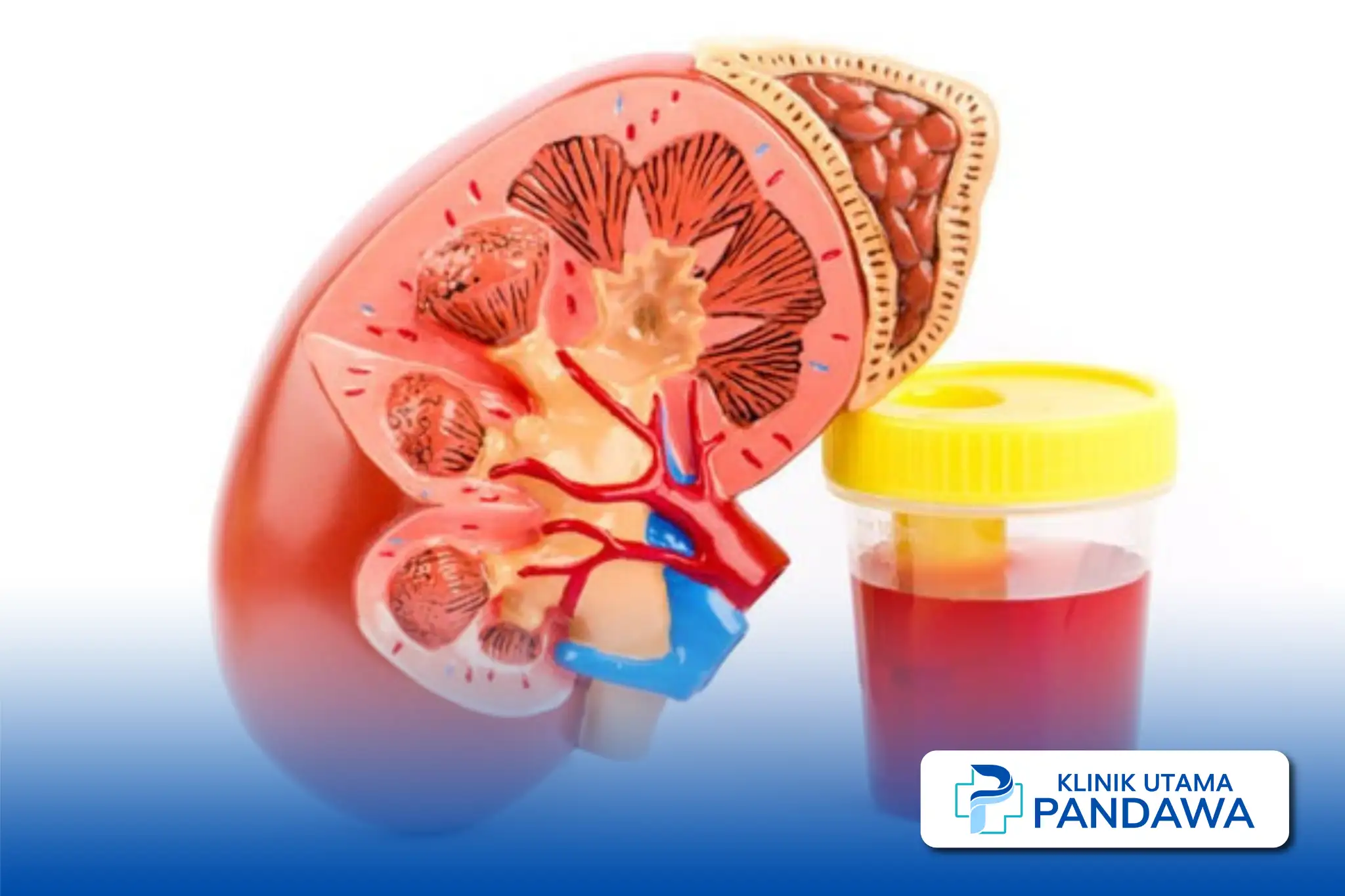 Hematuria