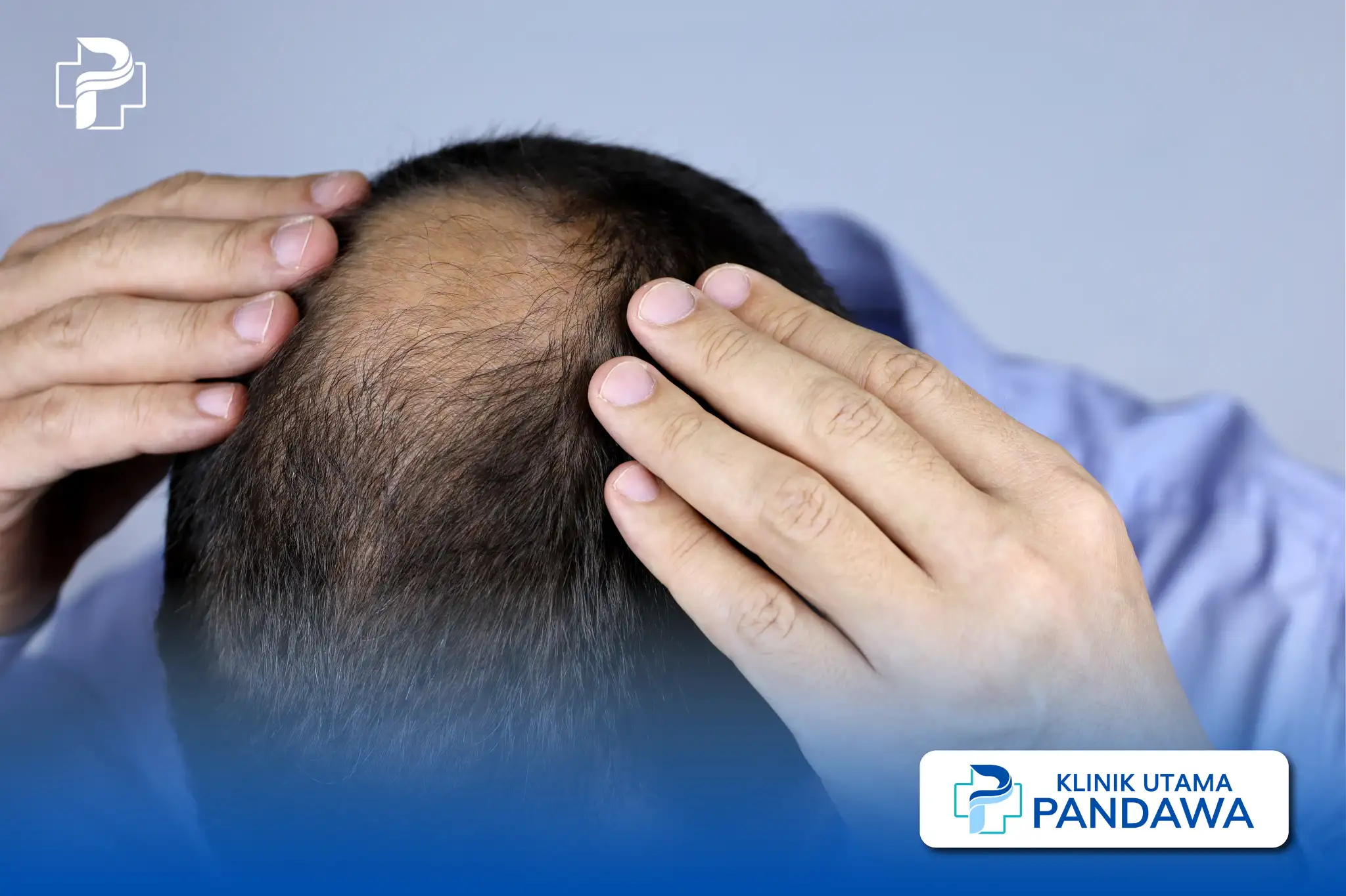 hair loss treatment