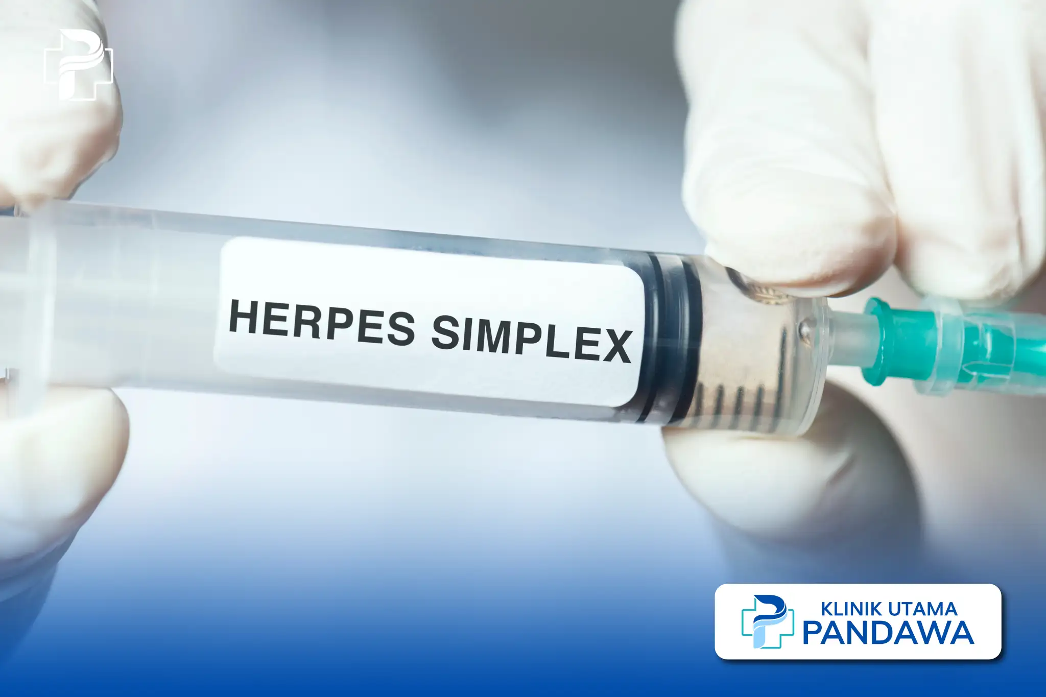 herpes simpleks