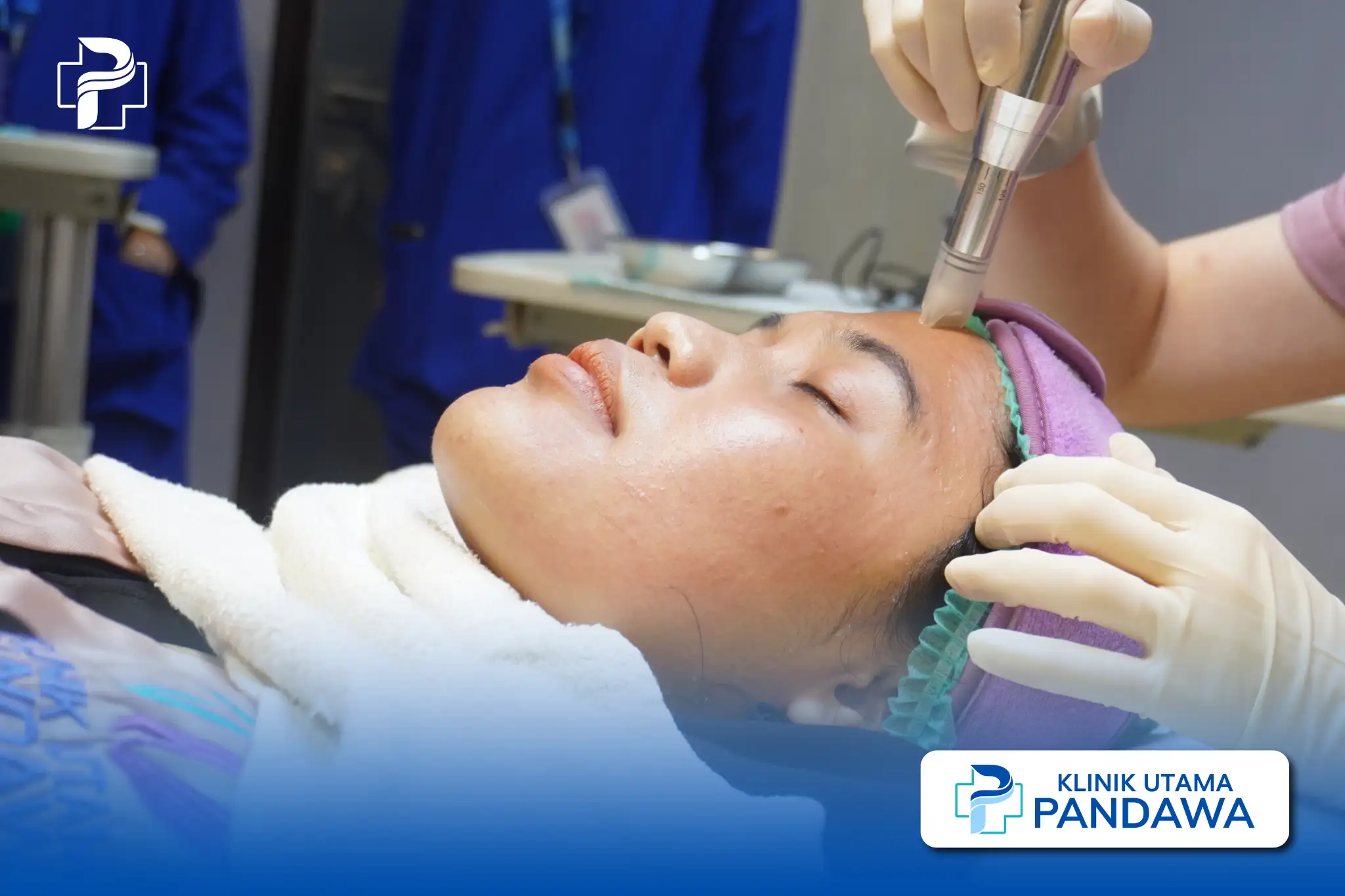 microneedling