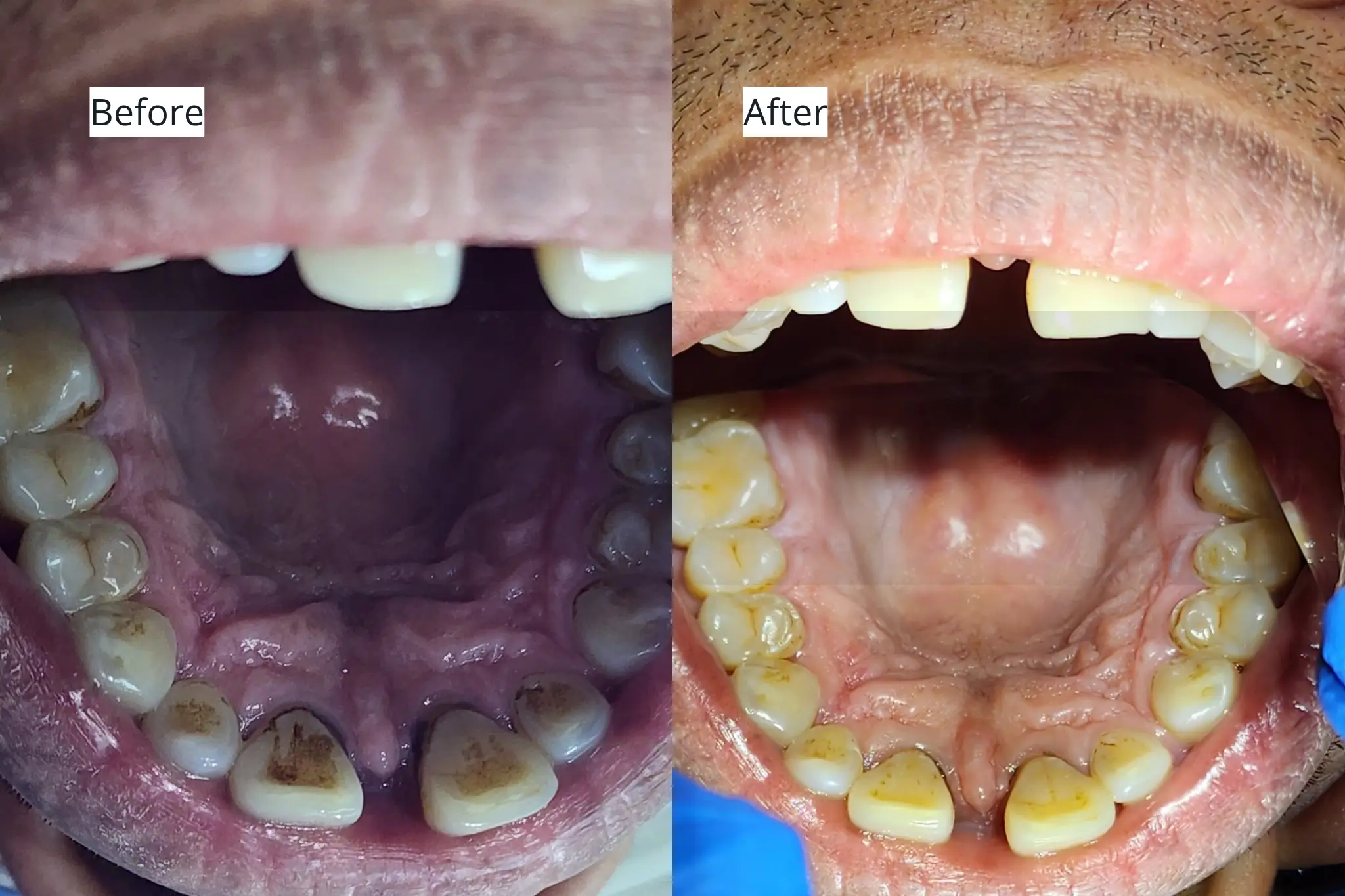 Before After Scaling Gigi 2