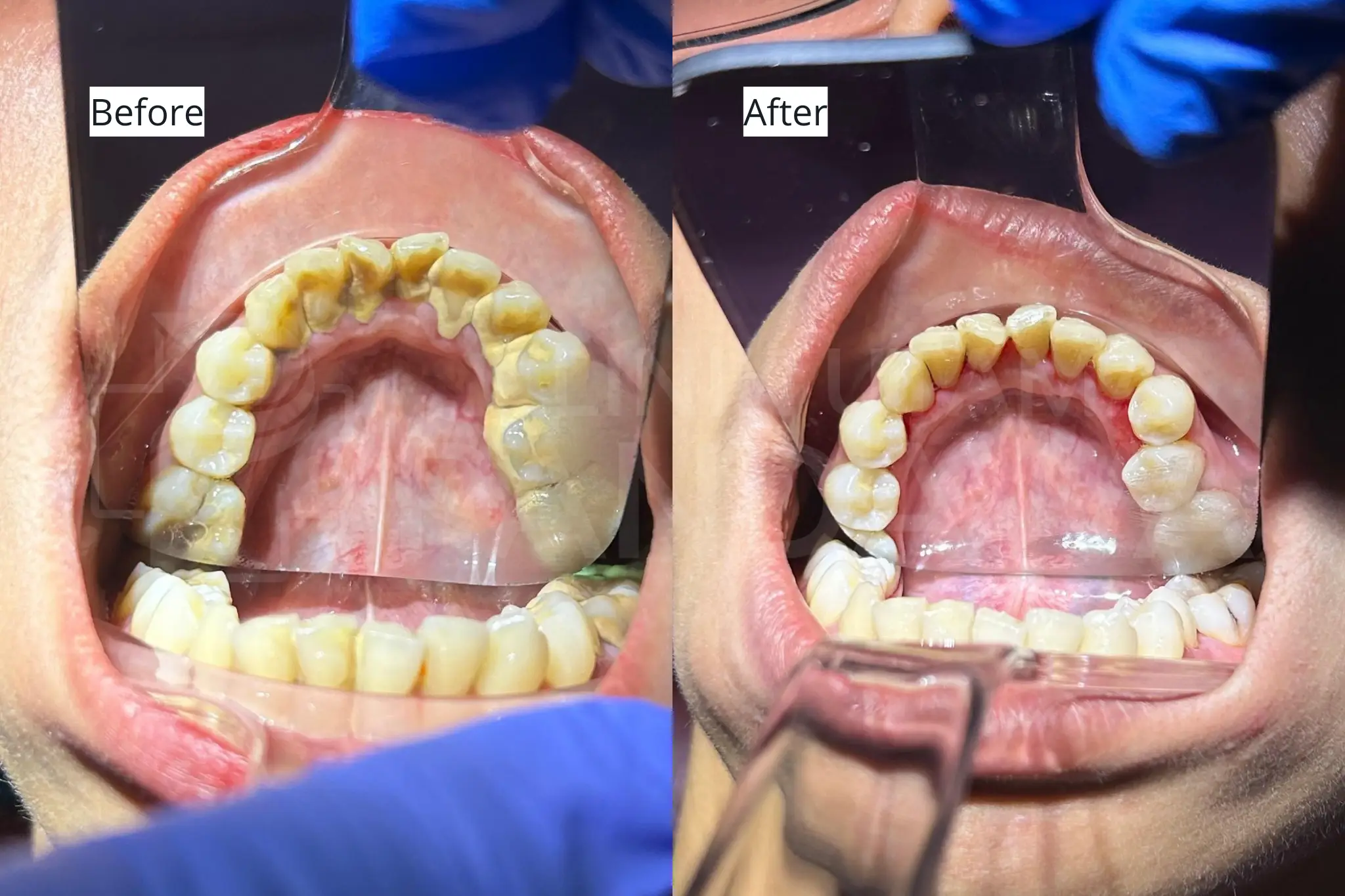 Before After Scaling Gigi 4