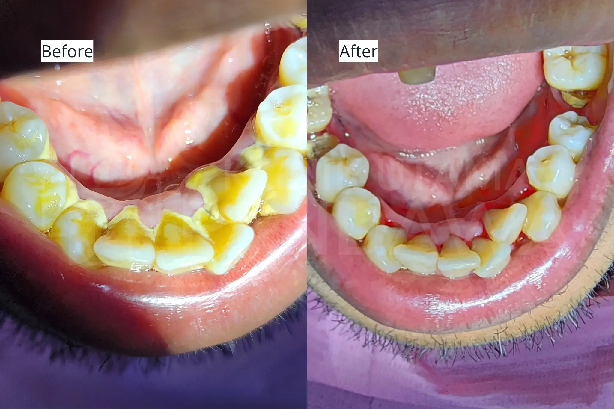 Before After Scaling Gigi 5