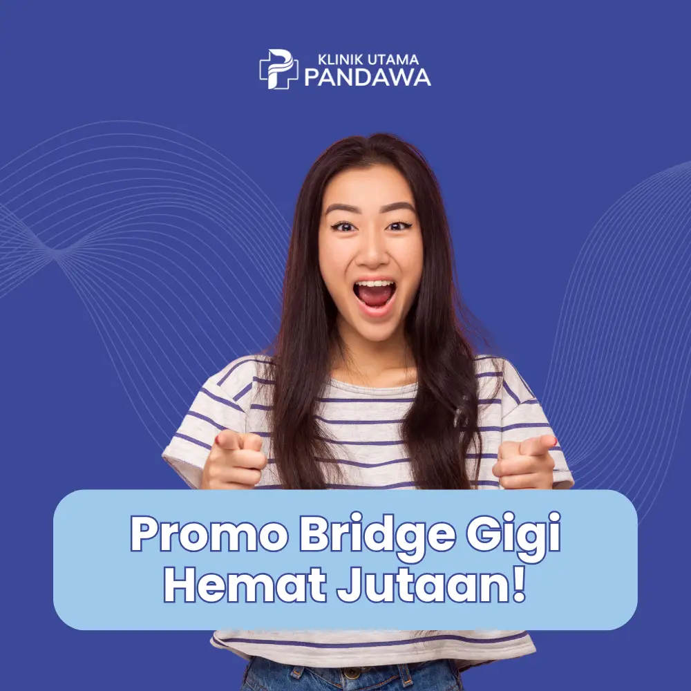 bridge gigi KUP