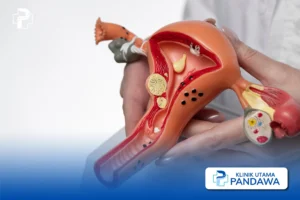Vulvovaginitis