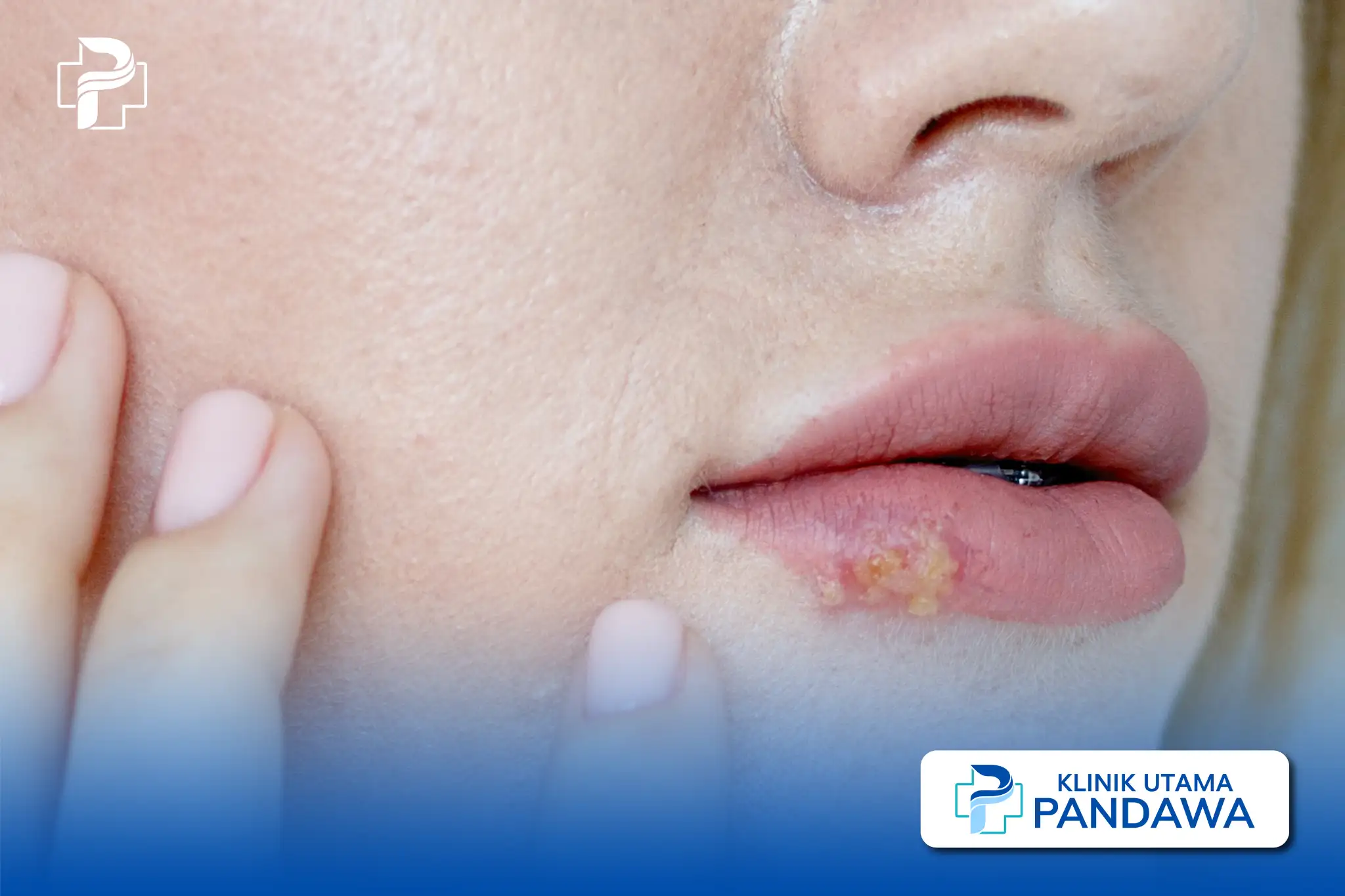 jamur di bibir