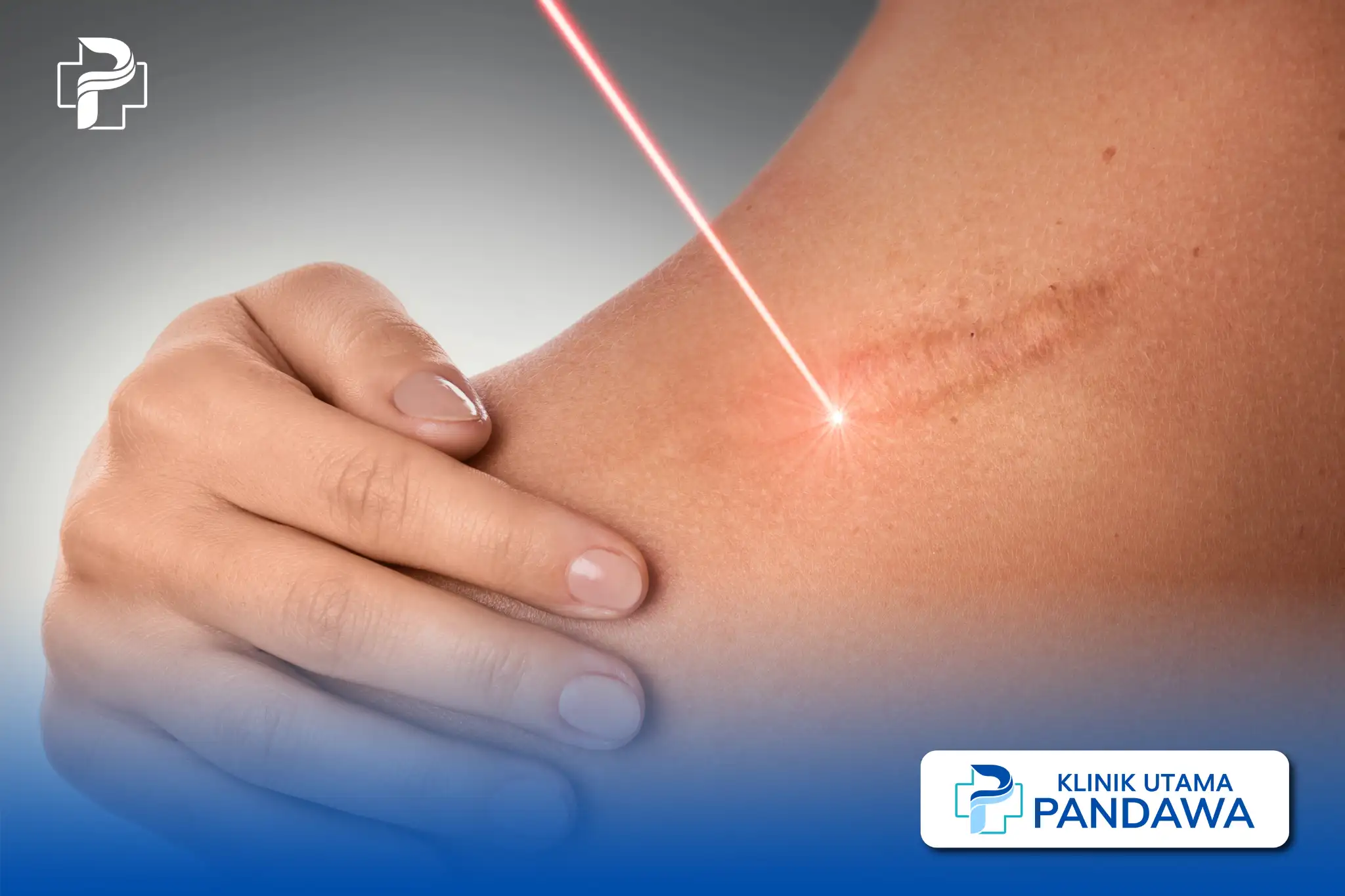 scar removal