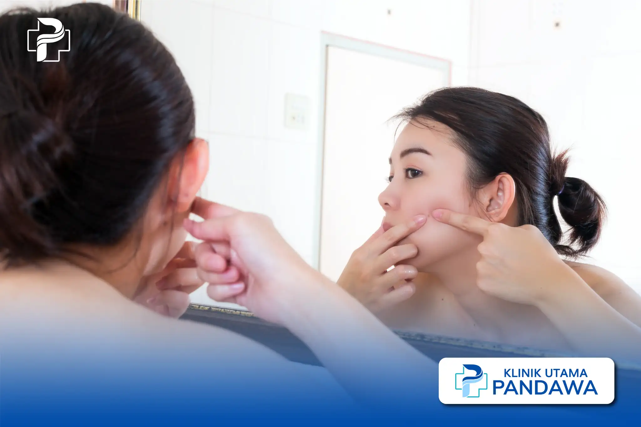 cara menghilangkan sebaceous filament